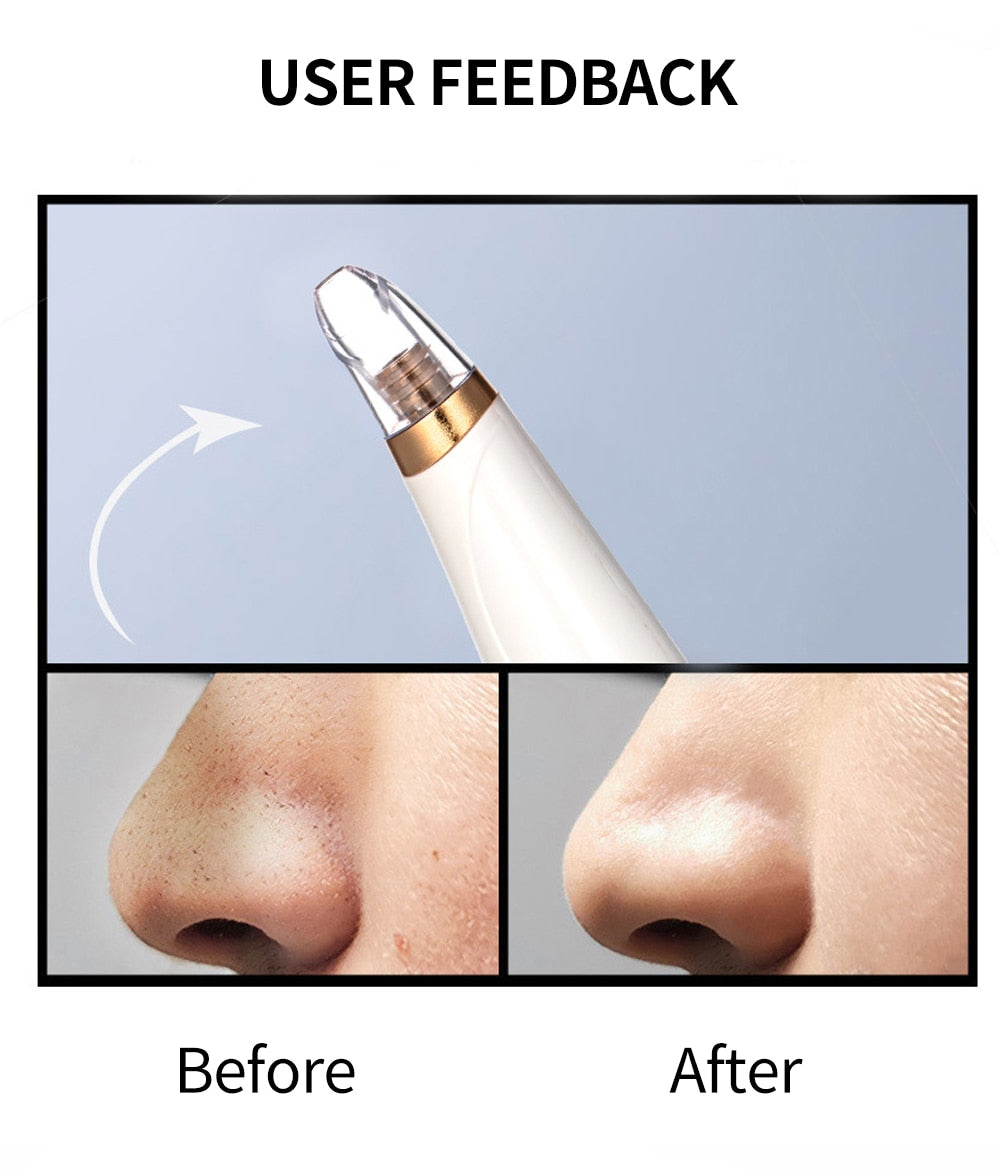 Blackhead Remover Vacuum Deep Pore Cleaner Facial Spa Tool